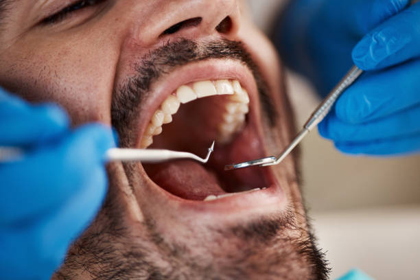 Dental Bonding in Maumee, OH